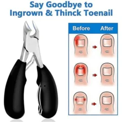 Coupe-ongles De Précision Pour Ongles épais Ou Incarnés